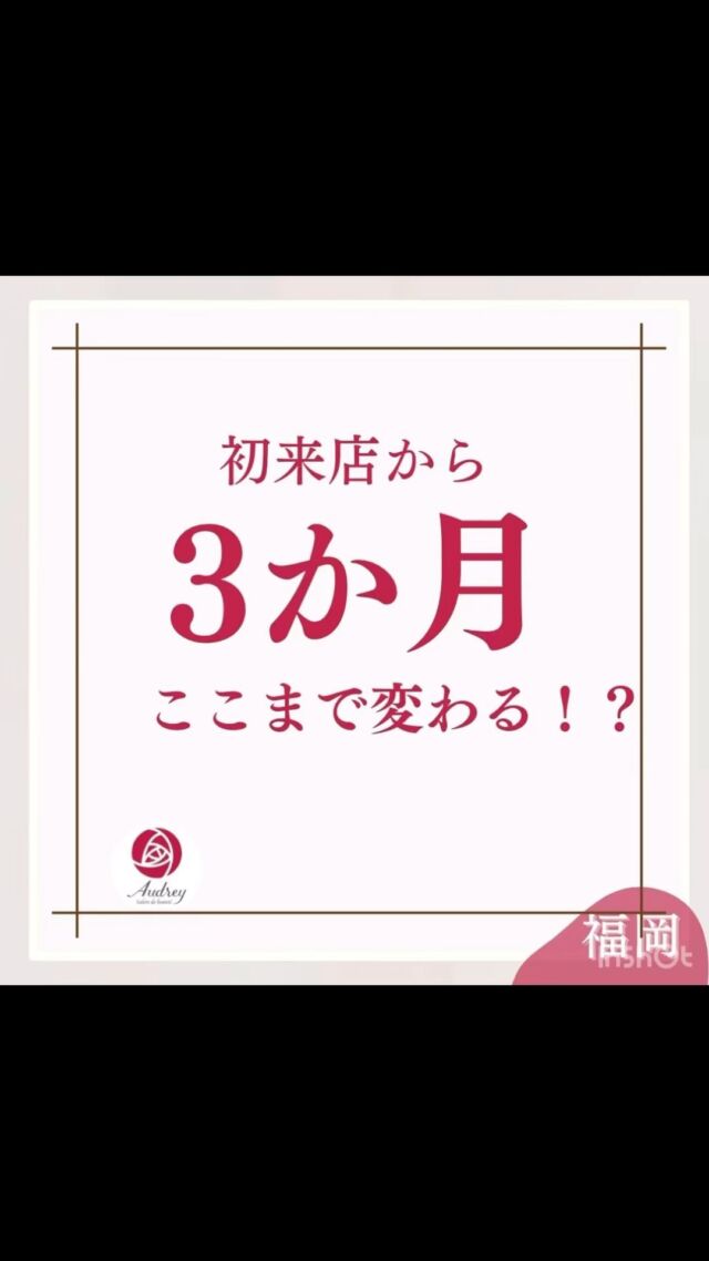 3か月で肌悩み解決✨

毛穴の黒ずみ、つまり、にきび、赤ら顔で
お悩みだった20代男性のお客様

繰り返しのサロンケアで毛穴を小さく
詰まりにくい目立たない毛穴に。

ホームケアもスキンケアの見直し
スキンケアの基本のやり方をお伝え
ご自宅でも毎日こつこつと肌ケア

みるみる赤みがひき、毛穴が目立たない
つやつやなお肌に✨

まだまだ美肌を極めていきます👨‍🦱

オシャレもさらに楽しくなり
スキンケアにもやり甲斐を感じさらに
ケアに力をいれられています✨

お肌で気持ちも前向きに✨
いい事しかない美肌づくり✨

1人で悩まずご相談ください☺️

🌹いちご鼻、黒ずみ角栓、毛穴の開き 
🌹一度の施術でスッキリきれいに 
🌹お得なクーポン情報はストーリーで 
🌹福岡市中央区大濠公園、天神から10分 

#福岡#福岡市#福岡美容
#毛穴ケア専門サロン #福岡エステサロン 
#福岡毛穴ケア #毛穴ケア専門店 
#毛穴エクストラクション福岡 
#スキンケア#肌質改善#いちご鼻#ざらつき#黒ずみ毛穴#毛穴#メンズエステ