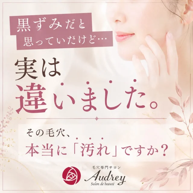 【その黒ずみ、本当に汚れですか？】

「毛穴が黒い＝汚れが詰まっている」
そう思って、一生懸命ケアを頑張っていませんか？💭

実は、黒く見える原因はひとつではありません。

酸化した皮脂や角栓
毛穴の影
産毛
メラニン色素　など…

原因が違えば、必要なケアも変わってきます。

自己流で何年も悩み続ける前に、
まずは自分の毛穴がどんな状態なのかを知ることが大切です😊

毛穴専門サロン Audreyでは、
お一人おひとりのお肌状態に合わせて最適なケアをご提案しています。

「何をしても変わらなかった」
「自分の毛穴の原因を知りたい」

そんな方は、ぜひお気軽にご相談ください🌿

📩 ご予約はInstagramのDM
または公式LINE、ホットペッパーから受付中です。

🎁 ご新規様限定
通常14,000円のフルコースが【9,800円】でお試しいただけます✨

あなたのお肌に寄り添い、理想の素肌づくりをサポートいたします🫧

#毛穴専門サロン 
#黒ずみ毛穴 
#いちご鼻 福岡毛穴ケア 
#福岡エステ 
#毛穴悩み